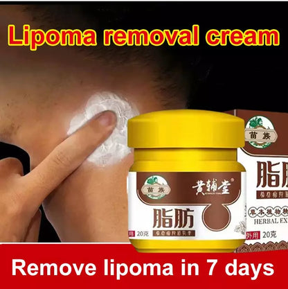 Lipoma Removal Cream