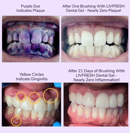 Color Correcting Whitening Toothpaste – Instant Brightening Formula