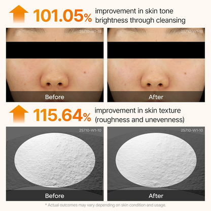 Kojic Turmeric Glow Spray – Gentle Exfoliating Brightening Mist