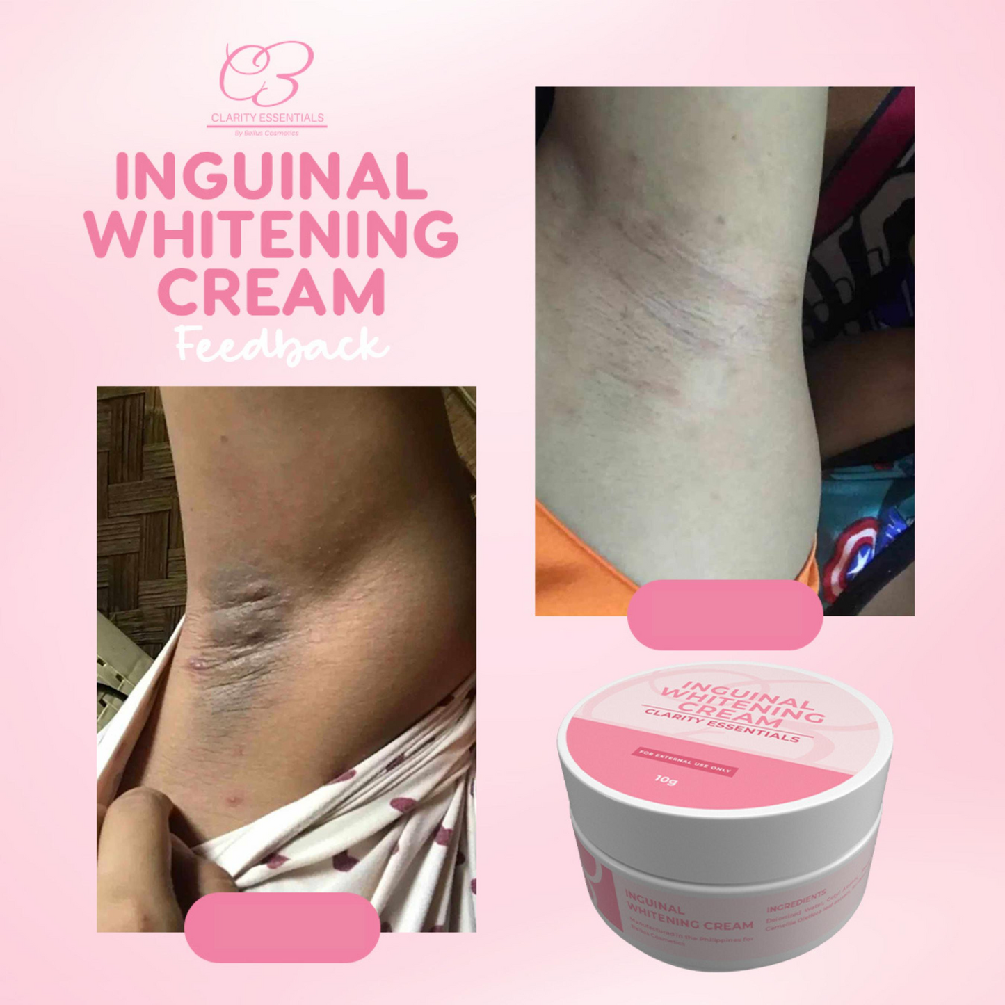 Intimate Area Brightening Cream – Daily Moisturizing & Skin Tone Care
