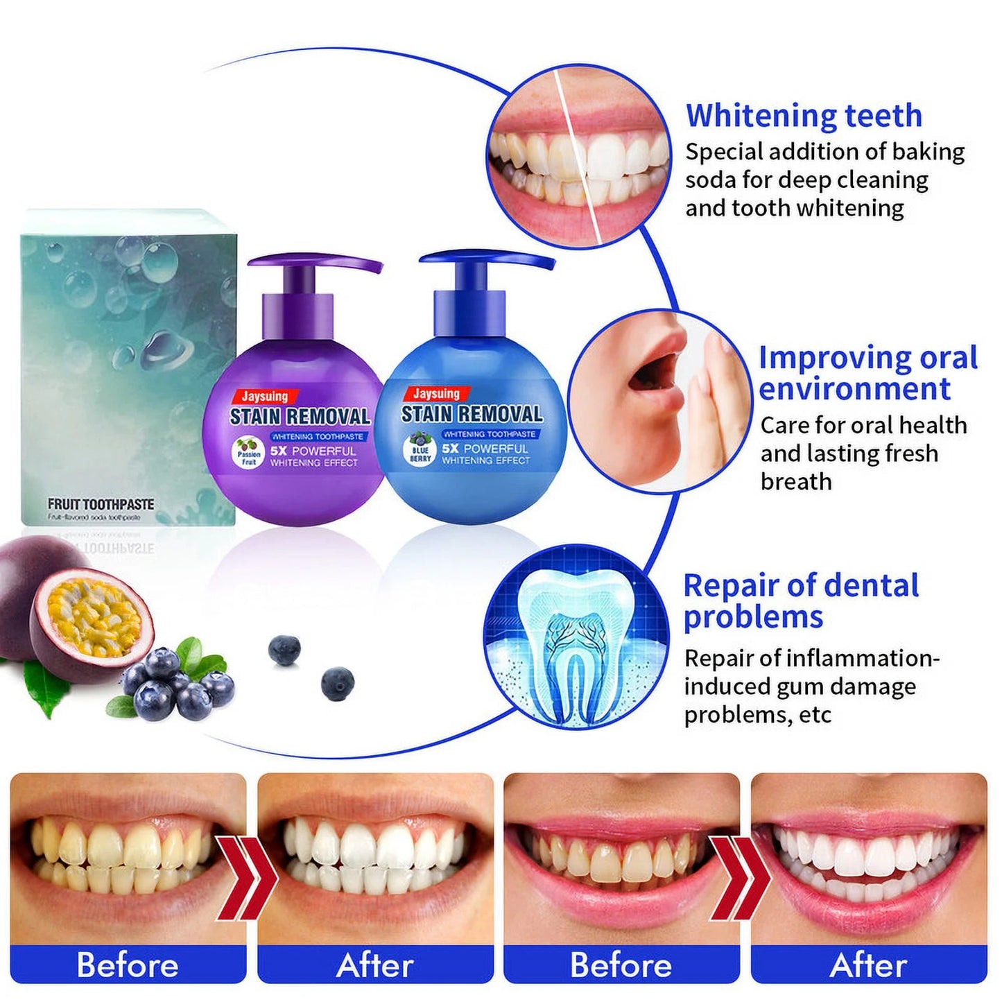 Intensive Stain Removal Whitening Toothpaste