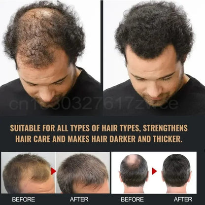 Fivfivgo™ Moroccan Hair Oil