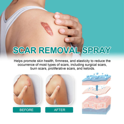 Advanced Scar Removal Spray