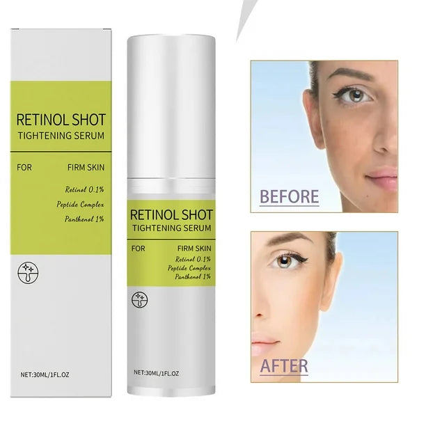 Retinol Tightening Serum – Firm, Smooth & Minimise Pores