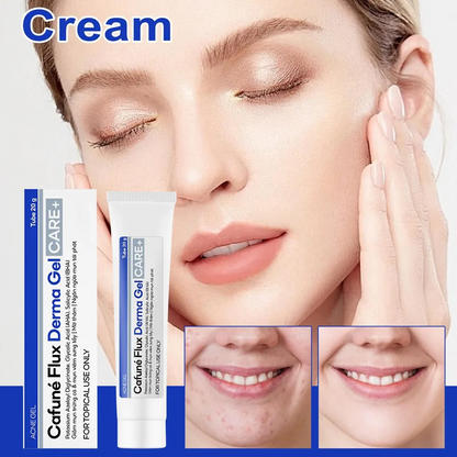 Cafuné Acne Spot Gel – Fade Acne Marks & Control Breakouts