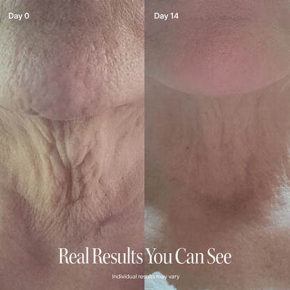 Neck Firming Roller Cream – Lift, Smooth & Tighten Skin
