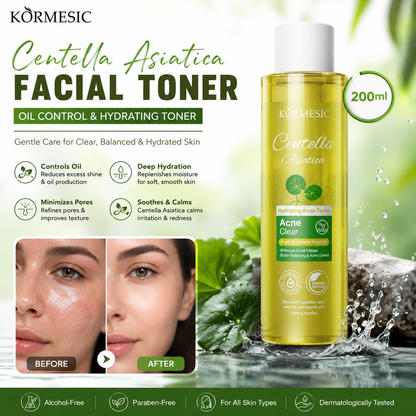 Centella Asiatica Facial Toner – Oil Control Hydrating Toner (200ml)