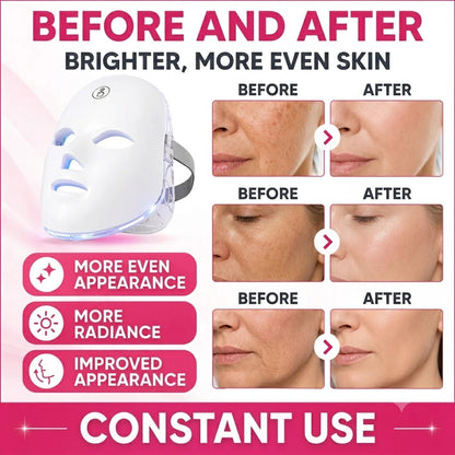 Wireless 7 Color LED Light Therapy Facial Device – Handheld Skin Care & Beauty Tool