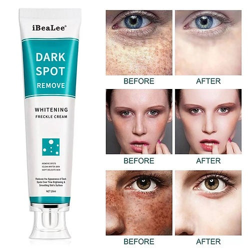 Spot Cream Melasma Remover – 30g Dark Spot & Freckle Corrector
