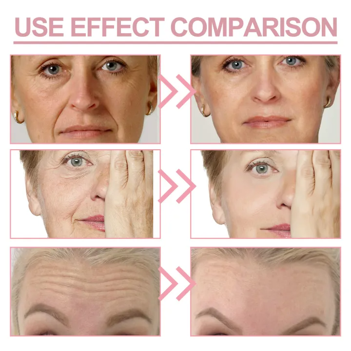GlowLift Balm – Instant Lifting & Long-Lasting Radiance