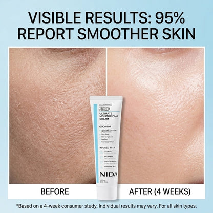 NIDA Ultimate Moisturizing Hydrating Face Cream for All Skin Types