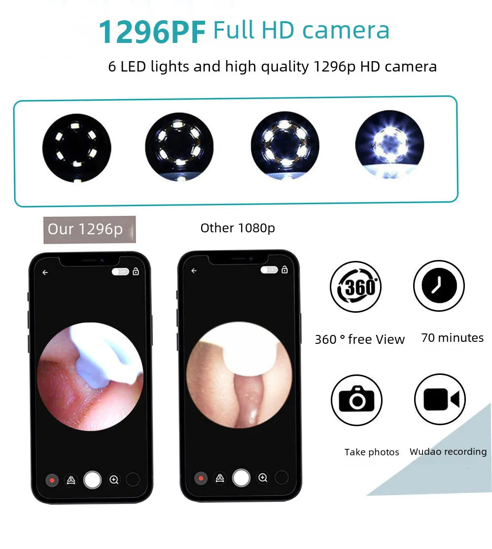 Visual Electric Ear Wax Removal Tool