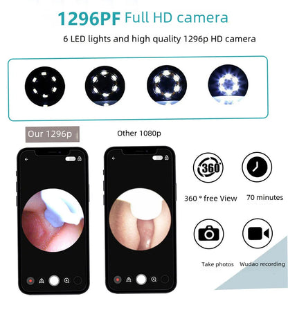 Visual Electric Ear Wax Removal Tool