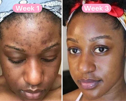 Exfoliating Turmeric Kojic Acid Pads