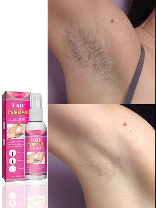 Body Hair Removal Spray