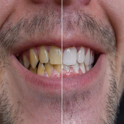 Intensive Stain Removal Whitening Toothpaste