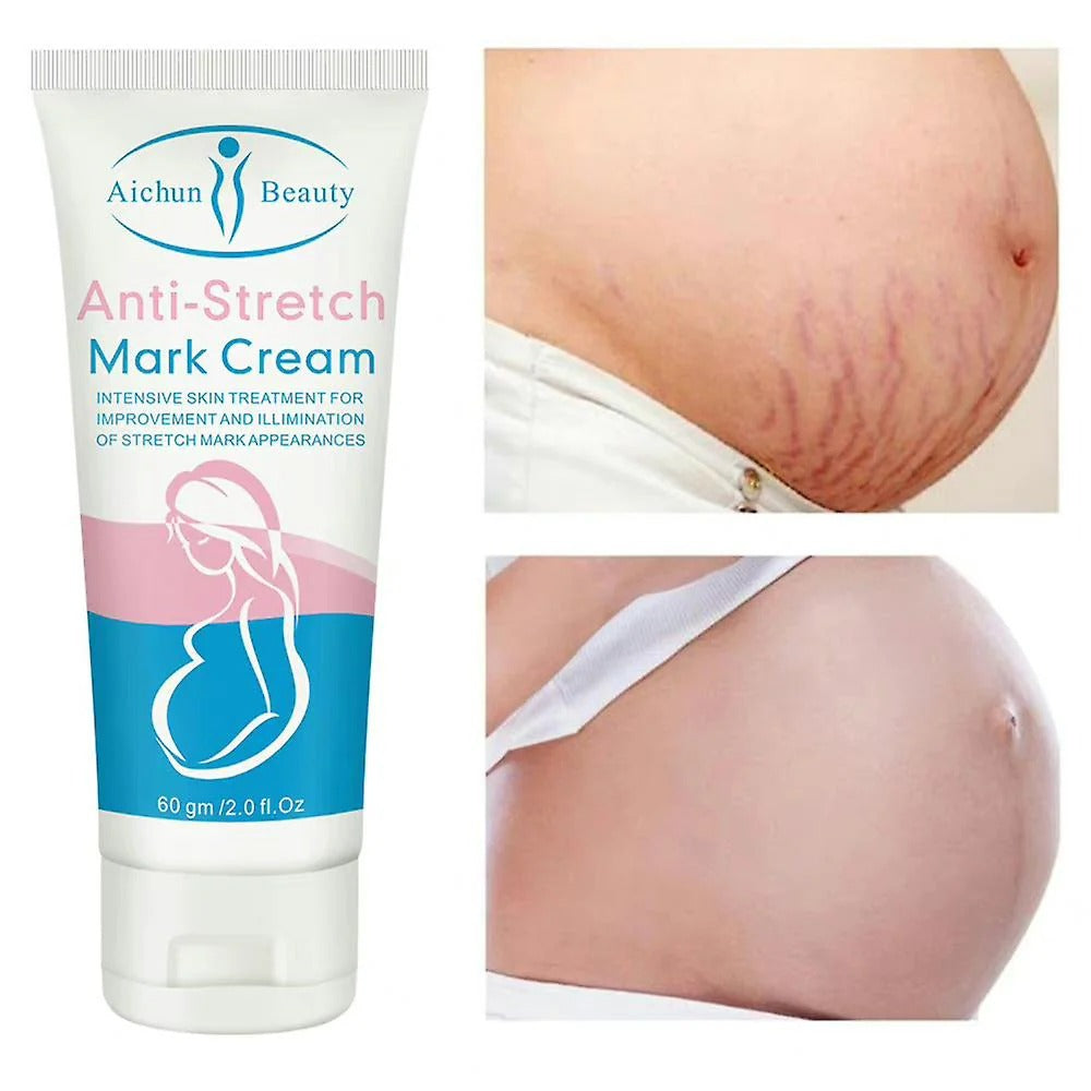 Aichun Beauty Natural Pregnancy Stretch Mark Cream