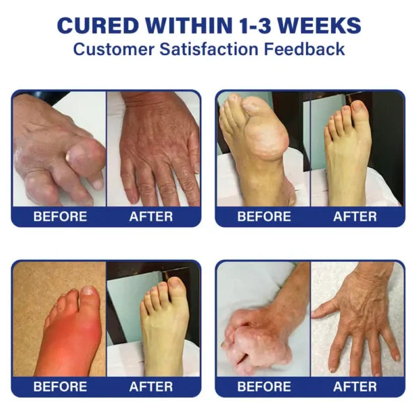 SkinMAX  Lidocaine Liquid – Maximum Strength Pain Relief