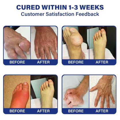 SkinMAX  Lidocaine Liquid – Maximum Strength Pain Relief