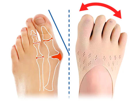 Bunion Relief Socks Realign & Soothe Feet Naturally