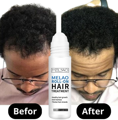 Maleo™ ScalpRevive Minoxidil Growth Roller