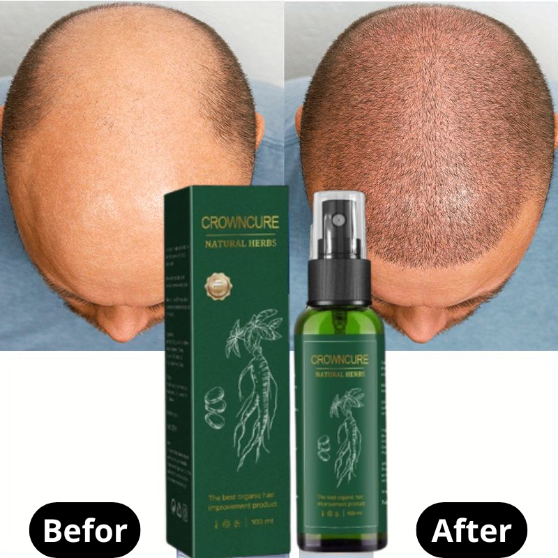 CrownCure™ RedGinseng HairRegeneration Spray