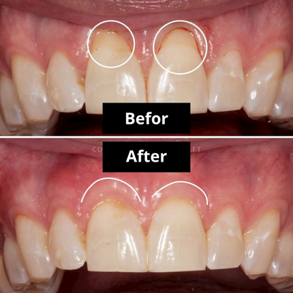 DentiZen™ Gum Therapy Gel