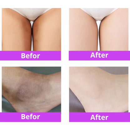 GlowDew™ Intimate Whitening Cream