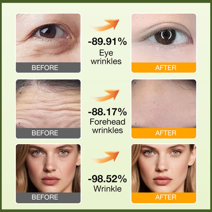 Retinol Tightening Serum – Firm, Smooth & Minimise Pores