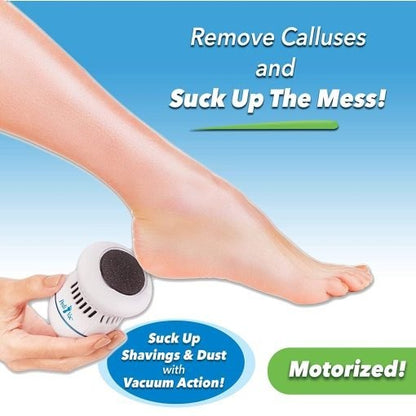 Pedi Vac Electric Callus Remover — Smooth Feet Care Tool