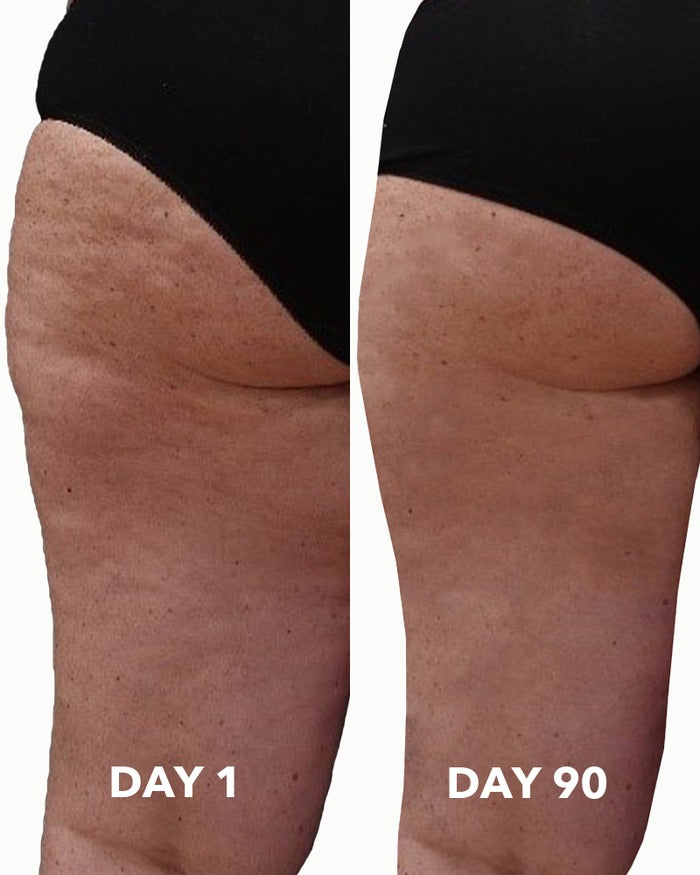 Anti Cellulite Massage Oil – Collagen Infused Moisturizing Body Oil