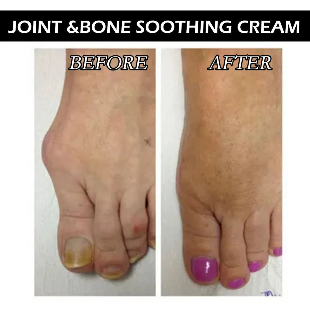 beevenom™ Bee Venom Joint Pain Relief Gel