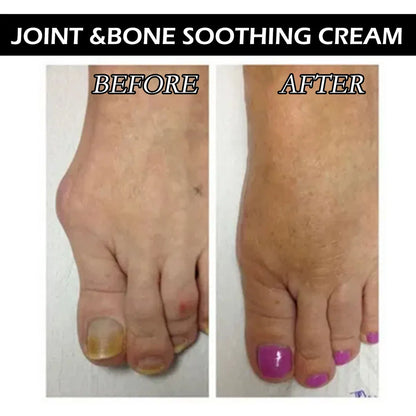 beevenom™ Bee Venom Joint Pain Relief Gel