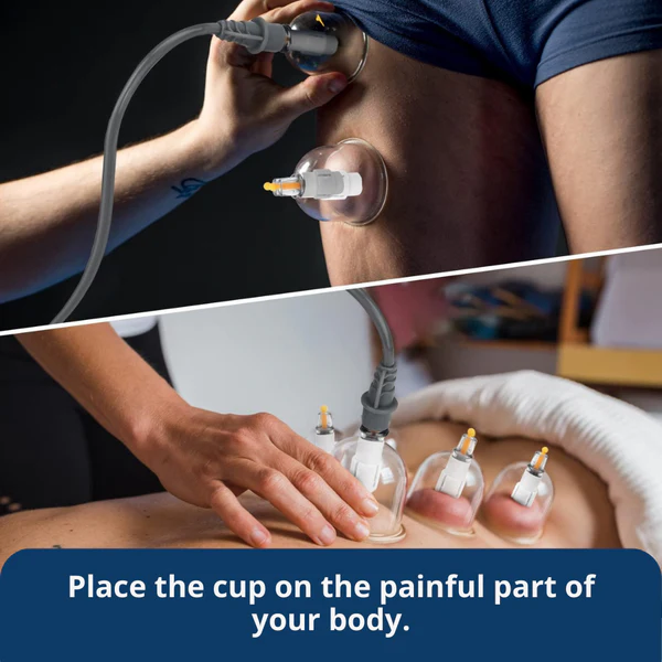 Professional Cupping Therapy Set – 12 Cup Massage & Recovery Kit