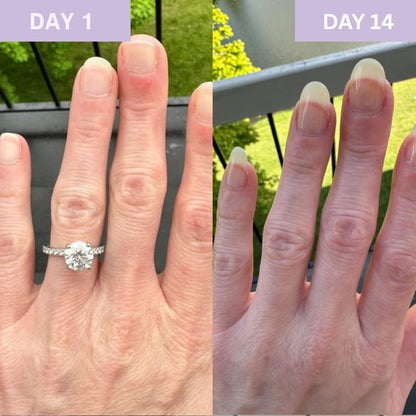 Nail Care Oil – Nourishing Cuticle & Nail Treatment for Natural Shine
