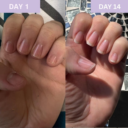 Nail Care Oil – Nourishing Cuticle & Nail Treatment for Natural Shine