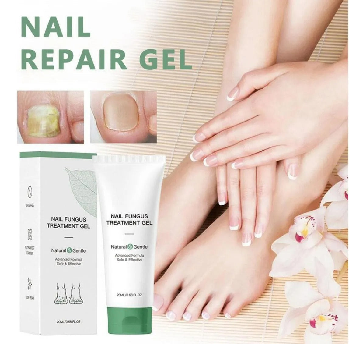 Nail Fungus Treatment Gel – Restore Healthy & Clear Nails Fast