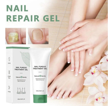 Nail Fungus Treatment Gel – Restore Healthy & Clear Nails Fast