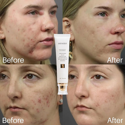 FATAZEN™ Organic Repair Cream – Multi-Action Skin Repair & Care