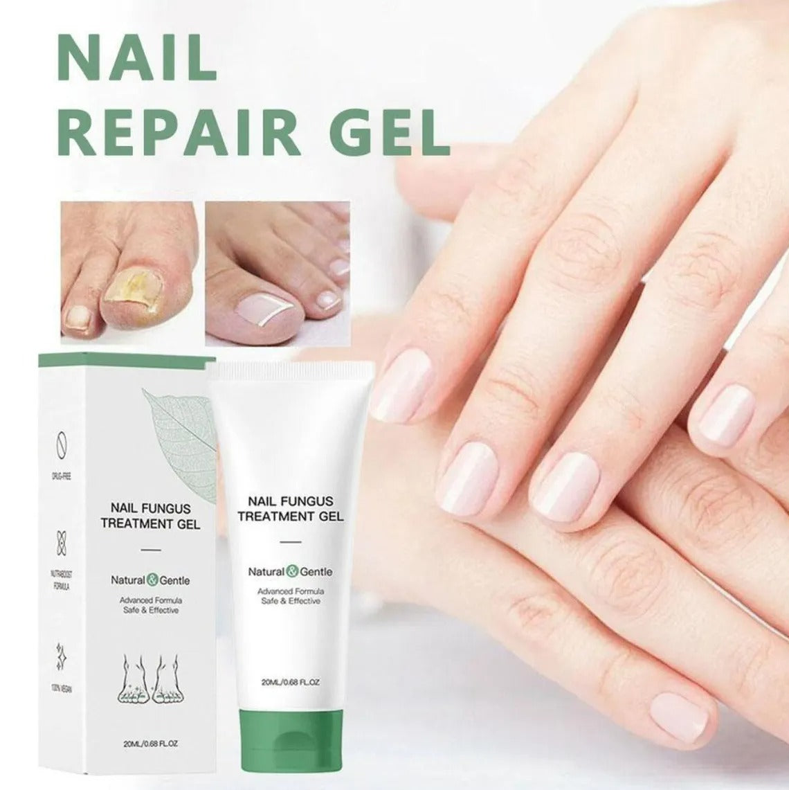 Nail Fungus Treatment Gel – Restore Healthy & Clear Nails Fast