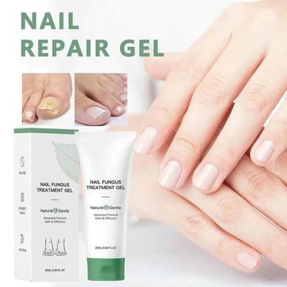 Nail Fungus Treatment Gel – Restore Healthy & Clear Nails Fast