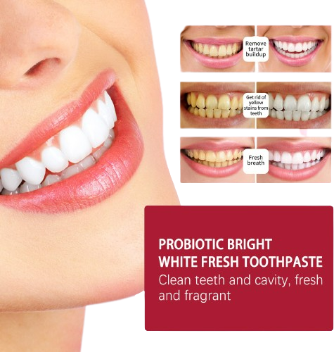 All Smiles-Brightening & Stain Removing Probiotic Toothpaste
