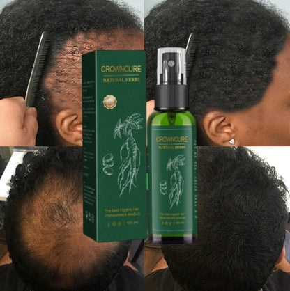 CrownCure™ RedGinseng HairRegeneration Spray