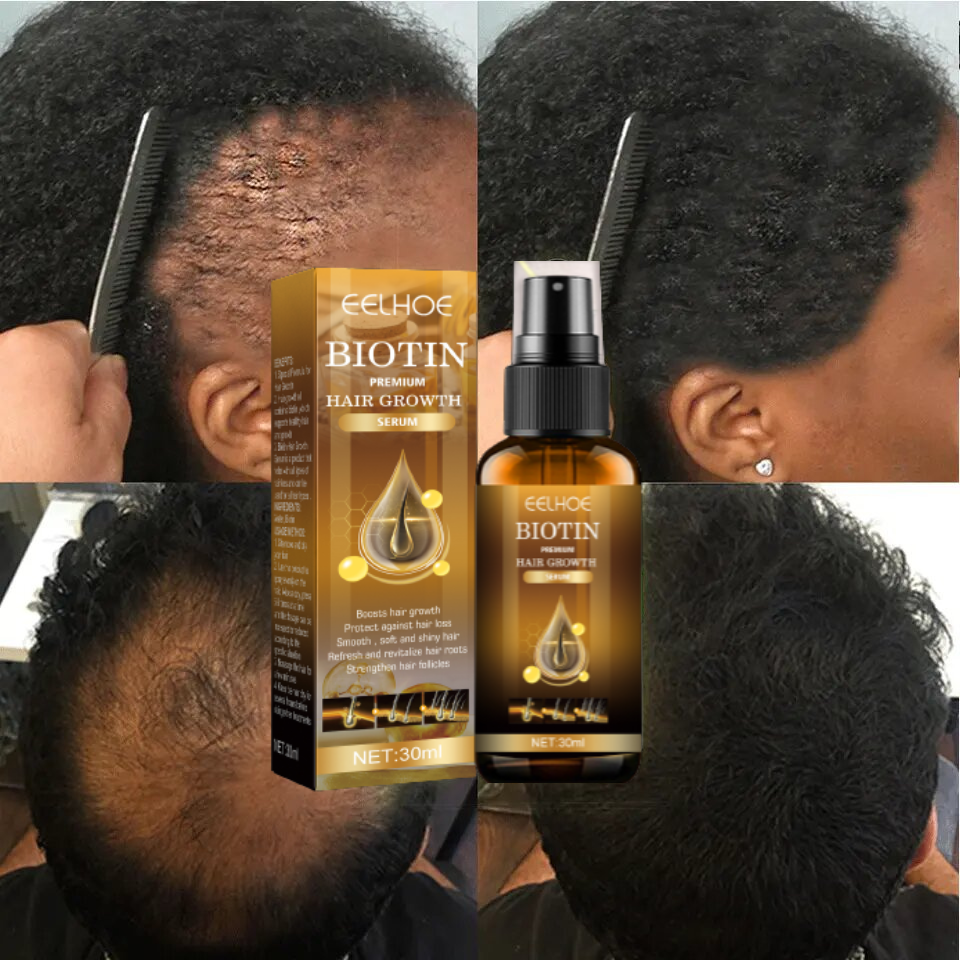 Biotin Hair Growth Spray