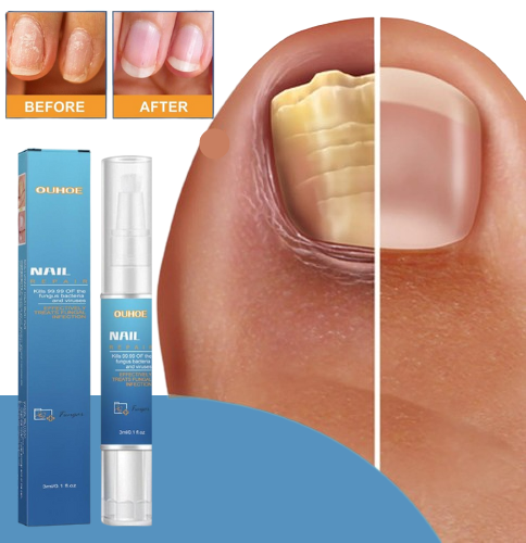 Nail Repair Pen