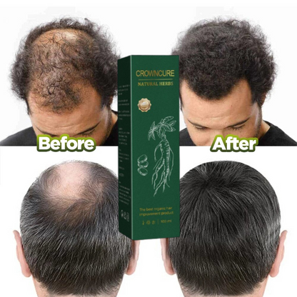 CrownCure™ RedGinseng HairRegeneration Spray