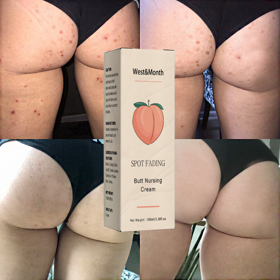 Bootieful™ Butt Treatment Cream