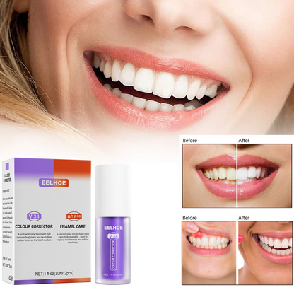 Teeth Colour Corrector Serum.