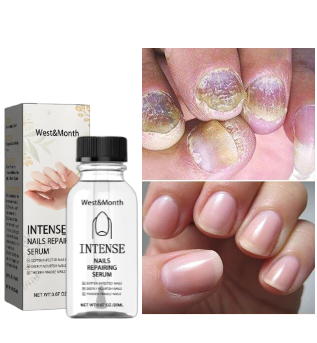 NailGro™ Intense Nail Growth and Strengthening Serum