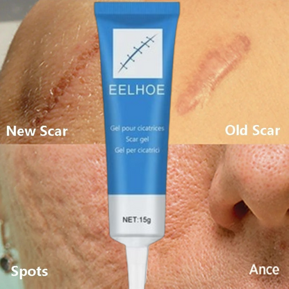 Organic Scar Removal Cream